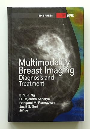 Multimodality Breast Imaging: Diagnosis and Treatment (SPIE Press Monograph) E. Y. K. Ng