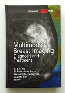 Multimodality Breast Imaging: Diagnosis and Treatment (SPIE Press Monograph) E. Y. K. Ng